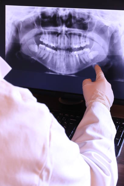 Best Chipped Tooth Repair Near Me  in Pimlico, SC