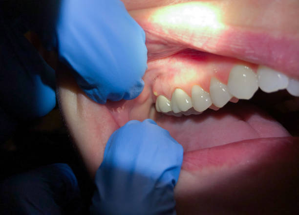 Best Cracked Tooth Emergency Dentist  in Pimlico, SC